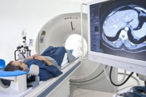 DCA and Cancer: Non-Hodgkin’s lymphoma cured in 4 months (Case presentation)