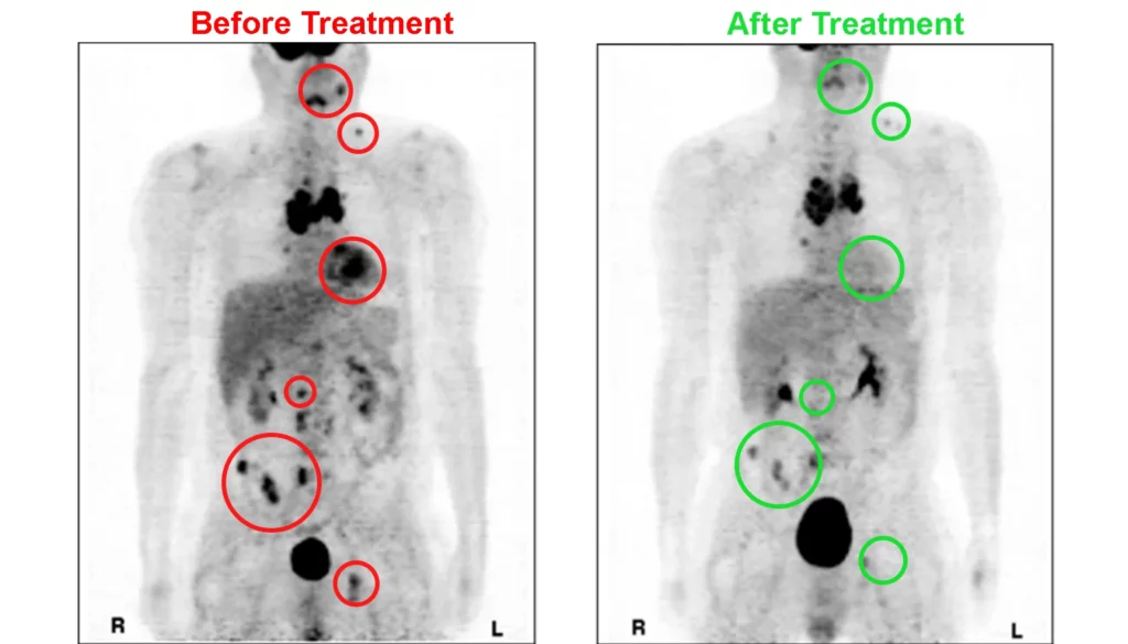 Before and afted Sodium DCA treatment photos